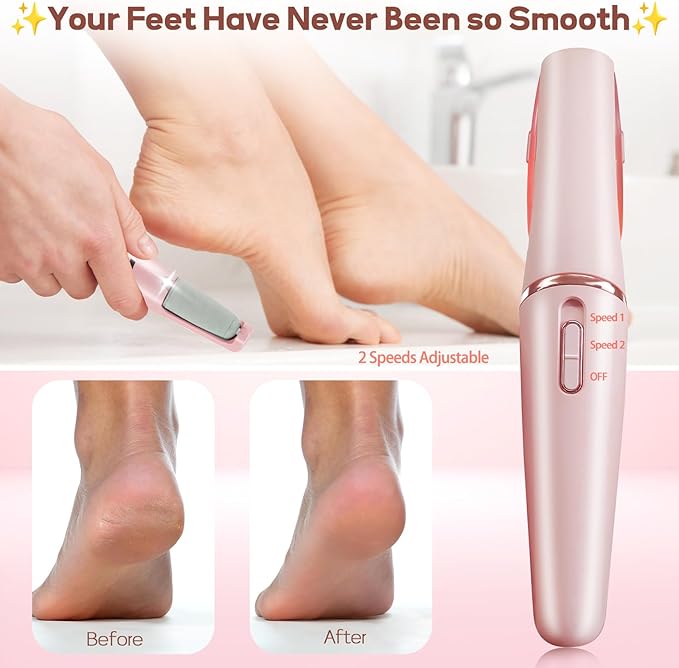 Foot Callus Remover